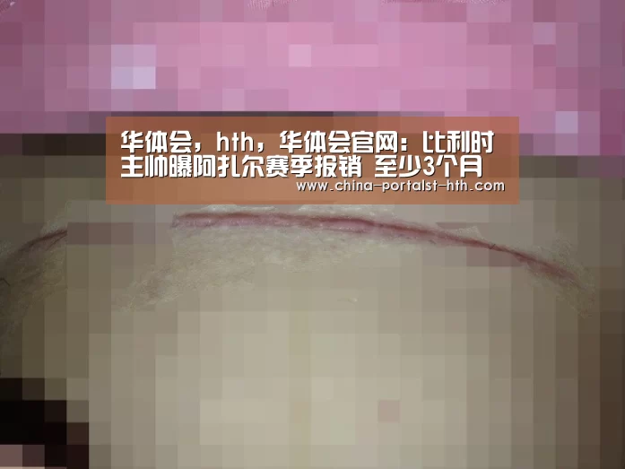 华体会,hth,华体会官网:比利时主帅曝阿扎尔赛季报销 至少3个月不能动(图1) 华体会,hth,华体会官网